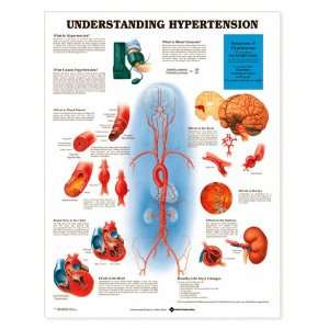 Understanding Hypertension Chart:  Industrial & Scientific