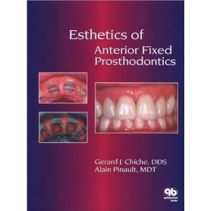   of Anterior Fixed Prosthodontics [Hardcover] Gerard Chiche Books