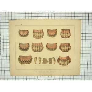  Colour Print Ages Horse Teeth Six Years Old Molars